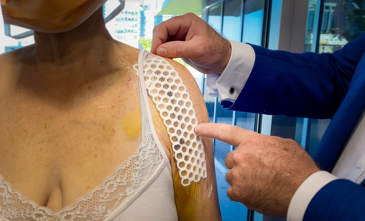 The two layers of dressing used after anatomic and reverse shoulder replacement surgery